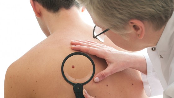 skin-health1-560×315
